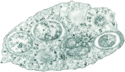 Wolbachia bacteria