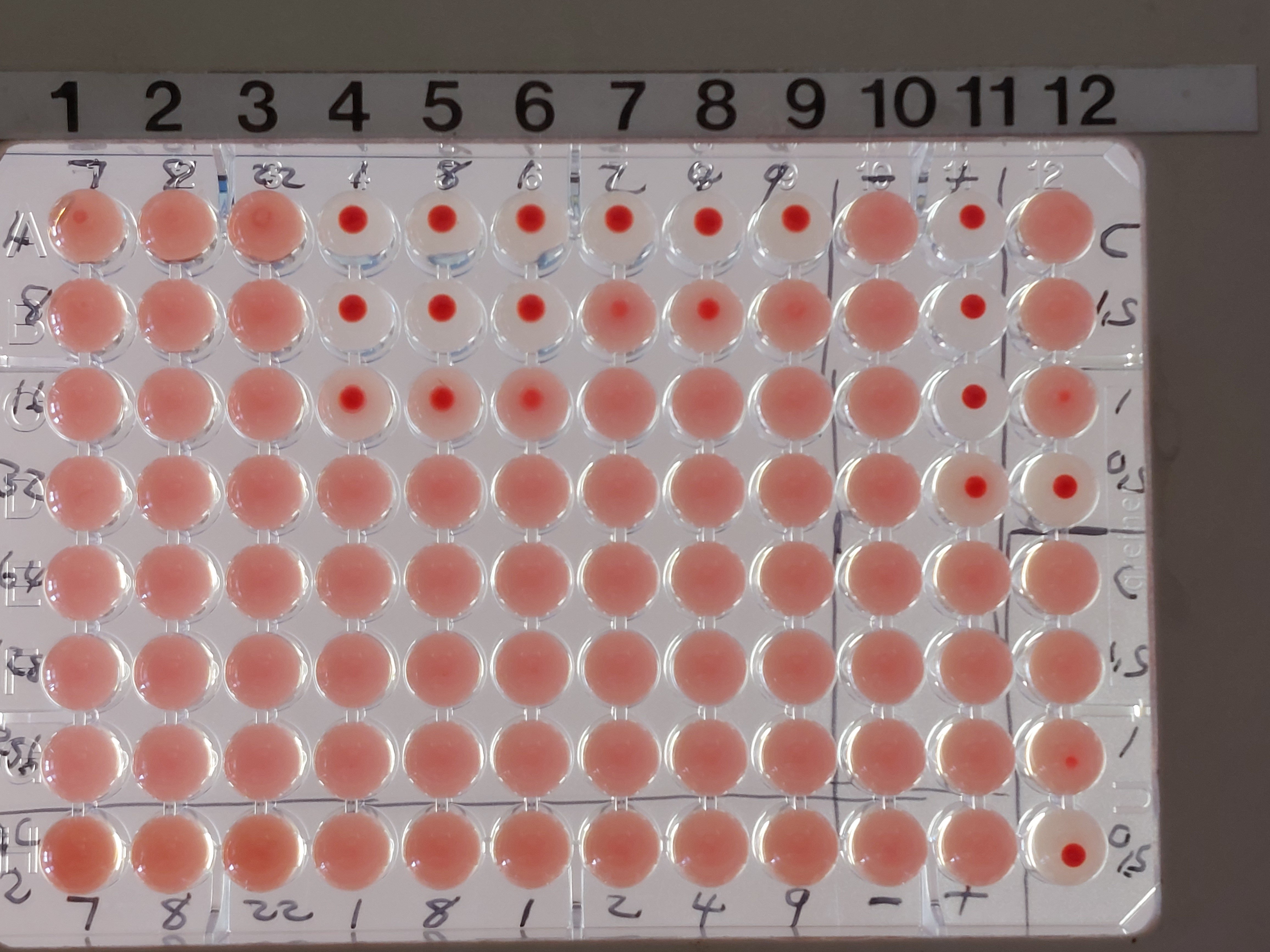 Bacteriology lab