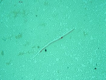 Acid phosphatase staining pattern of the microfilaria of Dirofilaria immitis, the causative agent of cardiovascular dirofilariosis (heartworm disease)